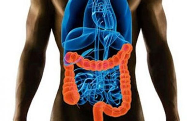 10 Τρόποι για να Αποφύγετε την Τροφική Δηλητηρίαση