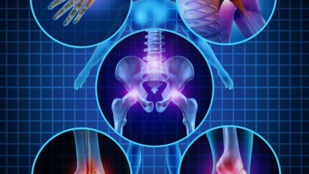 Παγκόσμια Ημέρα Οστεοπόρωσης